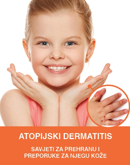 Atopijski dermatitis